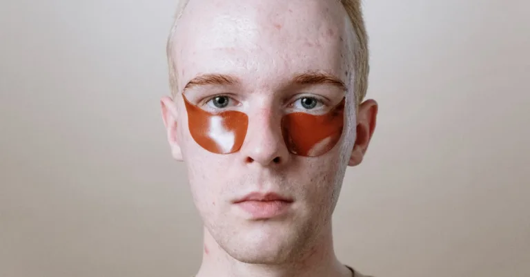 découvrez des solutions efficaces pour les problèmes cutanés autour des yeux, incluant irritations, boutons et soins adaptés pour une peau saine et éclatante.